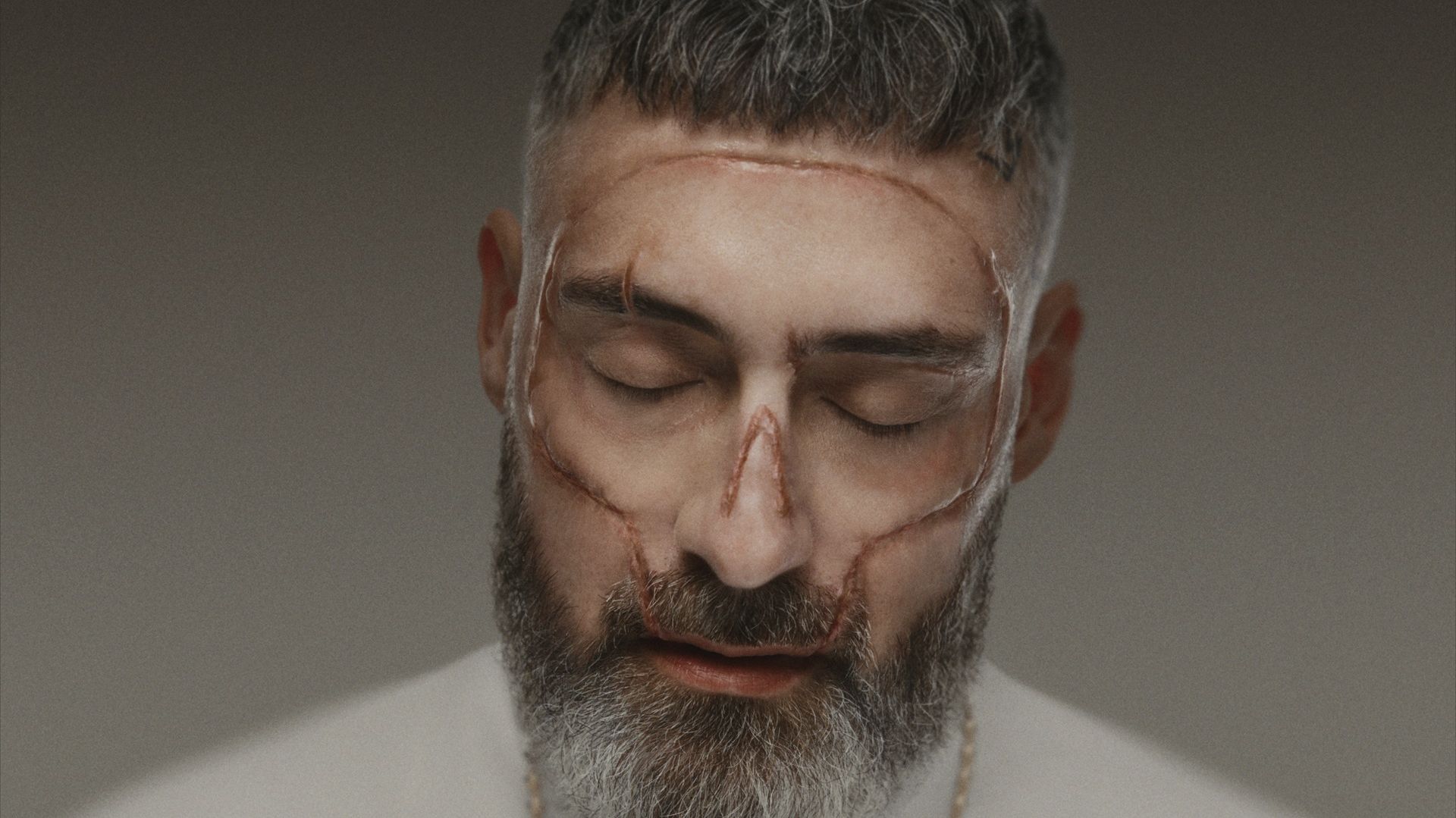 Nahaufnahme eines bärtigen Mannes mit geschlossenen Augen vor neutralem Hintergrund. Auf seiner Stirn, um die Augen, an den Wangen und auf der Nase sind deutlich sichtbare, rötliche Narben zu sehen. Er trägt ein helles Oberteil und eine dünne goldfarbene Kette. Sein kurzer dunkler Haarschnitt weist graue Strähnen auf.